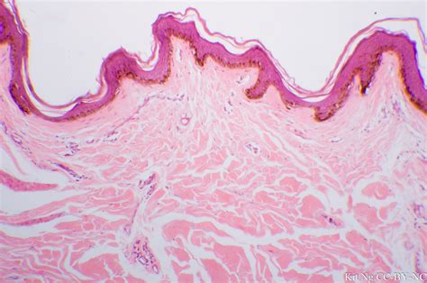 Dense Irregular Connective Tissue – Kit Ng, Ph.D.