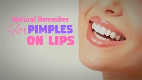 Excellent Home Remedies For Pimples On Lips That Work