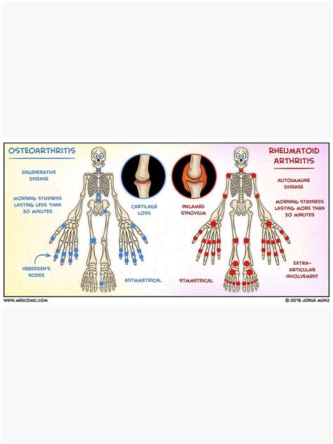 Osteoarthritis Vs Rheumatoid Arthritis Poster By Medcomic Redbubble