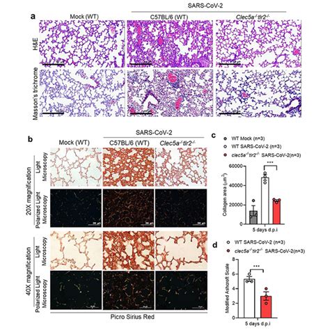 CLEC5A And TLR2 Are Critical In SARS CoV 2 Induced NET Formation And