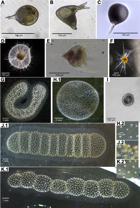 Rhizaria Radiolarians