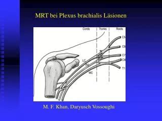 PPT TRAUMA PADA FLEKSUS BRACHIALIS PowerPoint Presentation Free