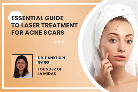 Essential Guide To Laser Treatment For Acne Scars