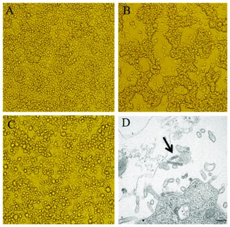 C Cell Cytopathic Effect Cpe Caused By Virus Isolates And