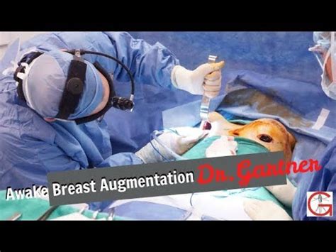 Awake Breast Augmentation Boob Job Before After Dr Gartner