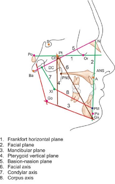 Cephalometric Planes Used For Angular Measurements On Lateral Cephalogram Download Scientific