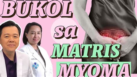 Bukol Sa Matris O Myoma Payo Ni Doc Willie Ong 1d Youtube