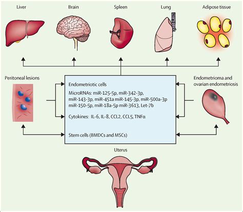 Endometriosis The Rise And Fall Of Hormones During The