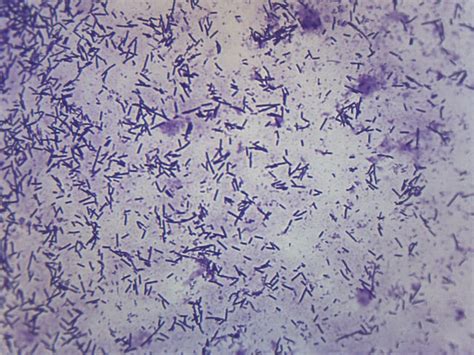 Eisco Prepared Microscope Slide Escherichia Coli Smear Gram Stain