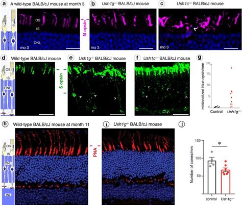 Mislocalization Of Cone Opsins In Ush C And Ush G Balb Cj Mice