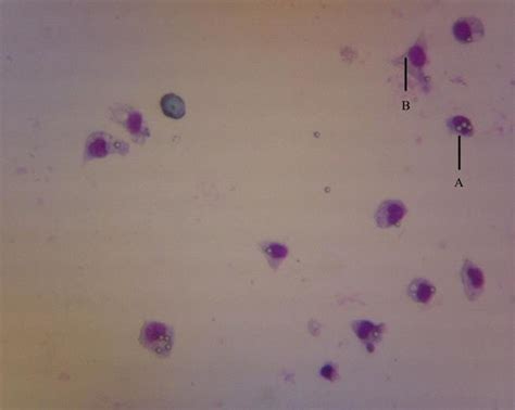 Macrophage Electron Microscopy