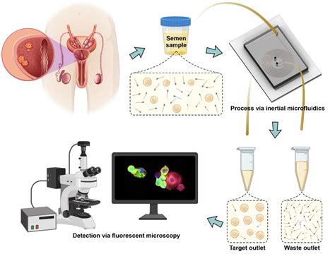 Figure 1 from Isolation of Circulating Tumor Cells from Seminal Fluid ...