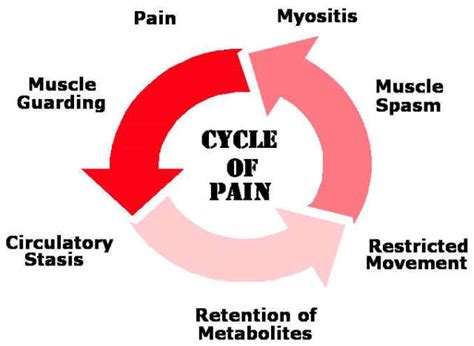 Pain Cycle Diagram