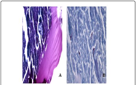 Special Stain Findings Acid Fast Stain High Power A Laminated