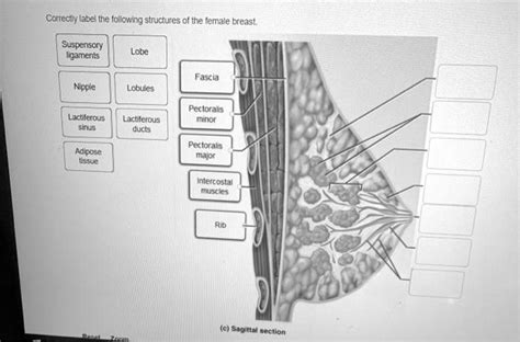 31 Correctly Label The Following Anatomical Structures Of The Female