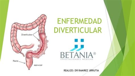 Enfermedad Diverticular