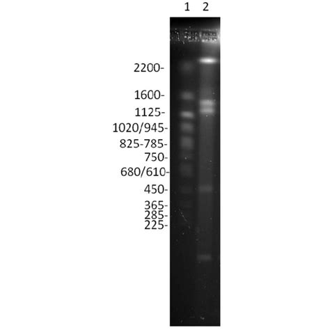 Pulsed Field Gel Electrophoresis Of Candida Vartiovaarae Ddna1