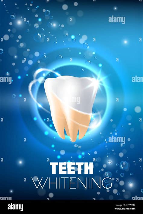 Teeth Whitening Ad Vector Realistic Illustration Stock Vector Image