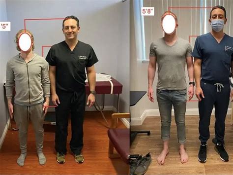 Doctor Goes Viral After Claiming He Can Make Patients 5 6 Inches Taller