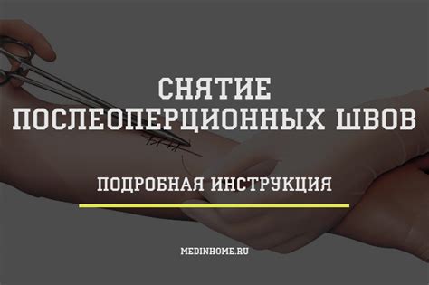 Снятие послеоперационных швов - подробная инструкция | MedInHome