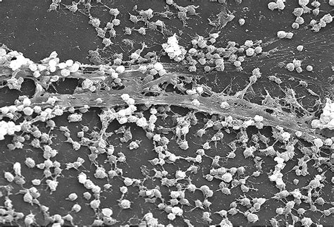 Free picture: biofilm, formation, lumen, indwelling, catheter, secreted ...