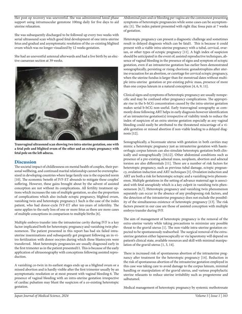 Blighted Ovum, intrauterine viable gestation and Left Tubal ectopic