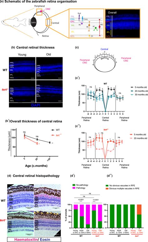 Müller Glia maintain their regenerative potential despite degeneration