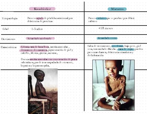 Pedía 2 Cuadro comparativo desnutrición Kwashiorkor Marasmo