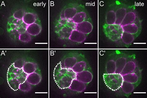 Dissection And Live Imaging Of The Late Embryonic Drosophila Gonad