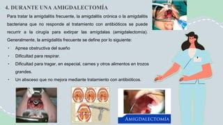 Amigdalectomia Pdf