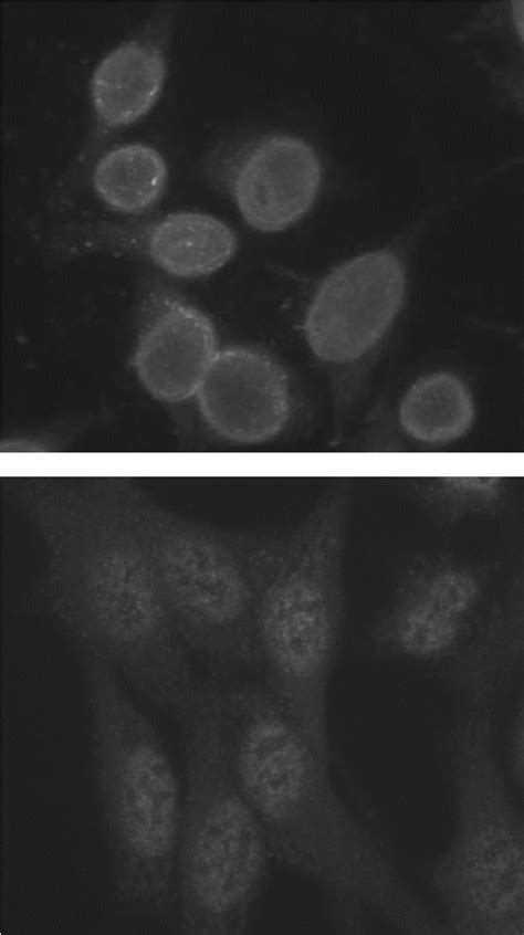 Figure 1 From ANN Based Classification Of Indirect Immuno Fluorescence