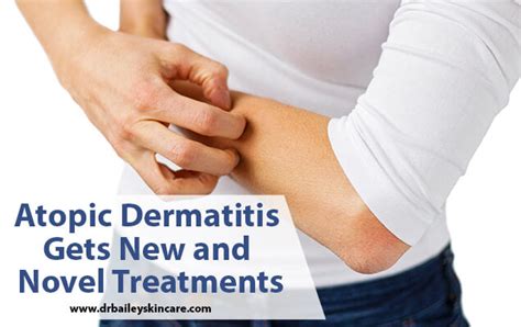 Atopic Dermatitis Gets New And Novel Treatments