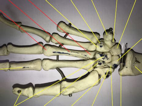 Palmar Surface Of Left Hand Diagram Quizlet