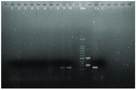 M Pcr Results For The Detection Of Pseudomonas Spp And P Aeruginosa Download Scientific