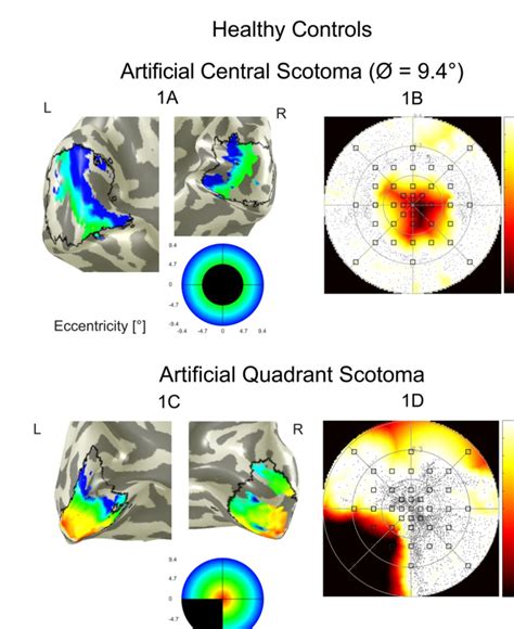 Correspondence Between Retinotopic Cortical Mapping And Conventional