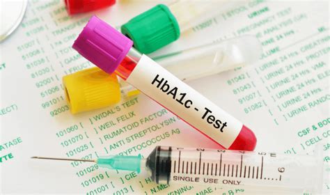 Diabetes Blood Test Hba1C Fasting At Christopher Maggio Blog