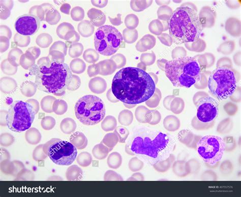 Hematology Society HS Blood Cells In Peripheral Blood Smear, 49% OFF