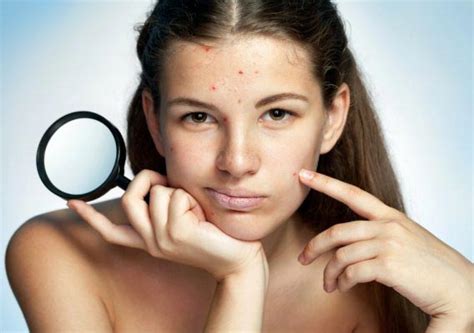 13 Creme Acne E Detergenti Brufoli TOP Per INCI Nel 2024