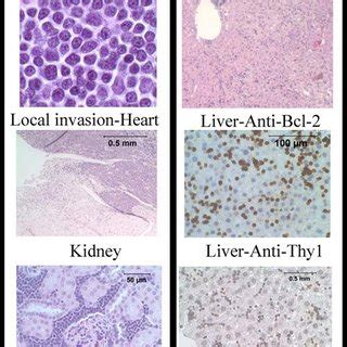 Spleens Were Dissected And T Cells Isolated From P27 Lck Bcl 2