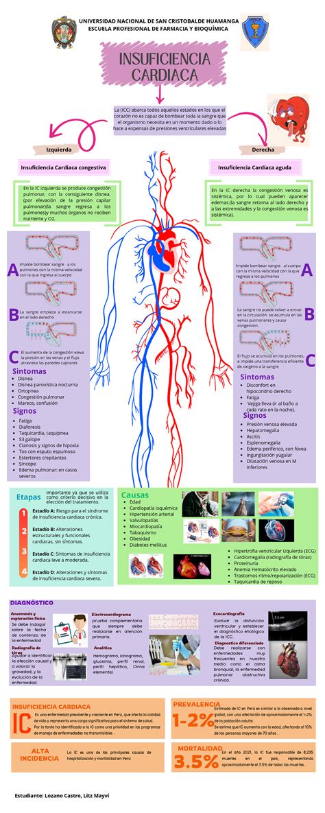 Infografía De La Insuficiencia Cardiaca Universidad Nacional De San