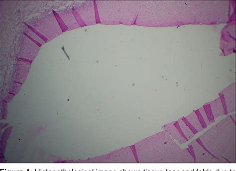 A Review Of Artifacts In Histopathology Semantic Scholar