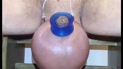 Saline Glucose Timelaps Gay Vintage Amateur Porn Feat Bigballll XHamster
