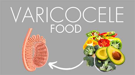 Best Foods For Varicocele Follow This Diet If You Have Varicocele