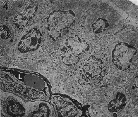 Figure 4 From Characteristics Of Capillary Permeability In Nasal Mucosa