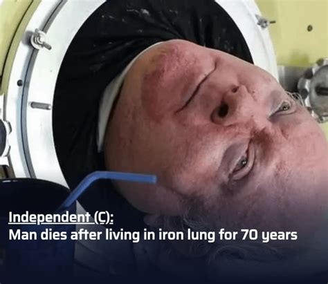 Paul Alexander Iron Lung Survivor Passes Away After 70 Years Rnewswall