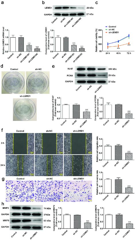 Insufficiency Of Lemd1 Hampers The Proliferation Of Hct116 Cells A