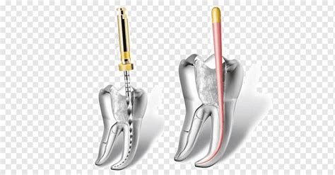 Endodontic Therapy Endodontics Root Canal Dentistry Health Surgery