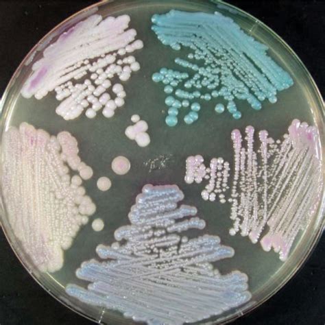 Figure 2 From Vital Growth Factors Of Malassezia Species On Modified