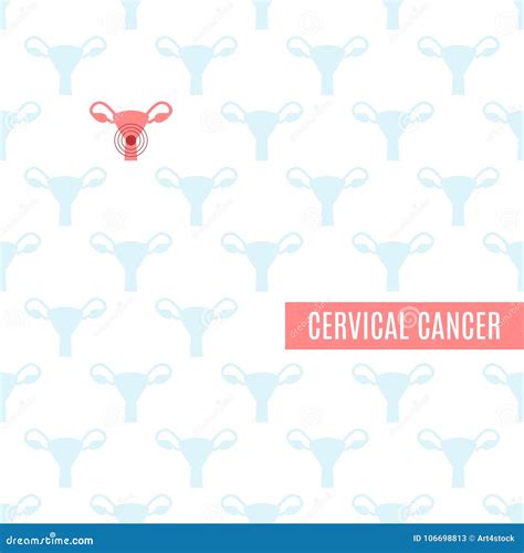 Cervical Cancer Awareness Poster Stock Vector - Illustration of color ...