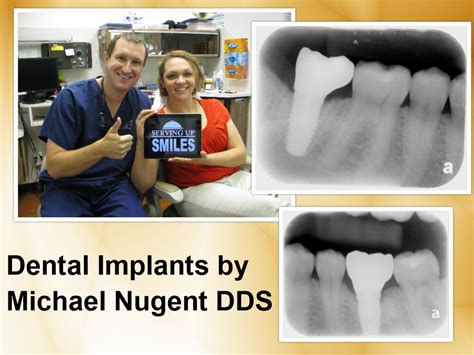 Collage8 The Pasadena Dentist Michael Nugent Dds